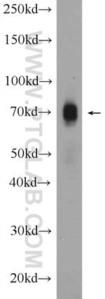 CXCR4 Antibody in Western Blot (WB)