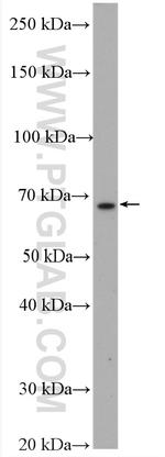 CXCR4 Antibody in Western Blot (WB)