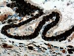 Oligophrenin 1 Antibody in Immunohistochemistry (Paraffin) (IHC (P))