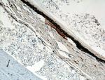 Oligophrenin 1 Antibody in Immunohistochemistry (Paraffin) (IHC (P))