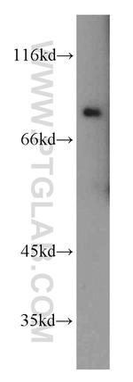 SLCO6A1 Antibody in Western Blot (WB)