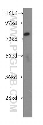 SLCO6A1 Antibody in Western Blot (WB)