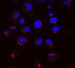 KDEL Receptor Antibody in Immunocytochemistry (ICC/IF)