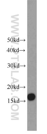 UBE2A Antibody in Western Blot (WB)