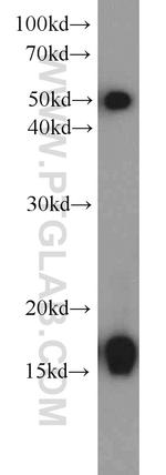 UBE2A Antibody in Western Blot (WB)