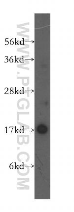 UBE2A Antibody in Western Blot (WB)