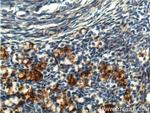 UCP2 Antibody in Immunohistochemistry (Paraffin) (IHC (P))