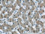 UCP2 Antibody in Immunohistochemistry (Paraffin) (IHC (P))