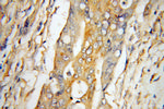 UCP2 Antibody in Immunohistochemistry (Paraffin) (IHC (P))