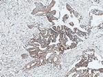 PPP1CC Antibody in Immunohistochemistry (Paraffin) (IHC (P))