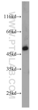 IFT57 Antibody in Western Blot (WB)