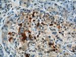 IFT57 Antibody in Immunohistochemistry (Paraffin) (IHC (P))