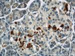 IFT57 Antibody in Immunohistochemistry (Paraffin) (IHC (P))