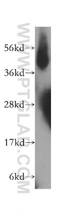 IFT57 Antibody in Western Blot (WB)