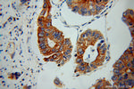 PARD3 Antibody in Immunohistochemistry (Paraffin) (IHC (P))