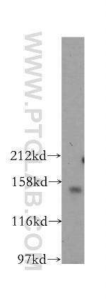 PARD3 Antibody in Western Blot (WB)