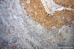 NME1 Antibody in Immunohistochemistry (Paraffin) (IHC (P))