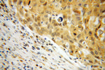 NME1 Antibody in Immunohistochemistry (Paraffin) (IHC (P))