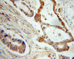 NME1 Antibody in Immunohistochemistry (Paraffin) (IHC (P))