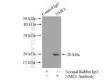 NME1 Antibody in Immunoprecipitation (IP)