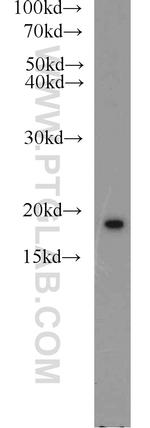 NME1 Antibody in Western Blot (WB)