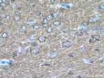 IRSp53 Antibody in Immunohistochemistry (Paraffin) (IHC (P))