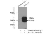 IRSp53 Antibody in Immunoprecipitation (IP)