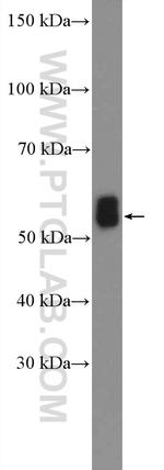 IRSp53 Antibody in Western Blot (WB)