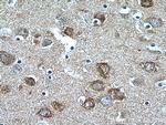 IRSp53 Antibody in Immunohistochemistry (Paraffin) (IHC (P))