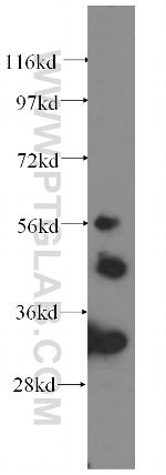 IRSp53 Antibody in Western Blot (WB)