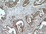 DNAJC7 Antibody in Immunohistochemistry (Paraffin) (IHC (P))