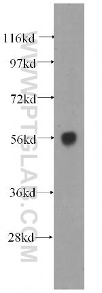 DNAJC7 Antibody in Western Blot (WB)