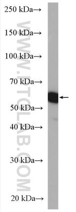 DNAJC7 Antibody in Western Blot (WB)