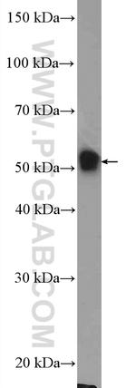 DNAJC7 Antibody in Western Blot (WB)