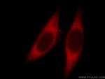 EMAP II Antibody in Immunocytochemistry (ICC/IF)