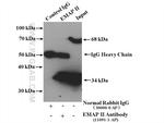 EMAP II Antibody in Immunoprecipitation (IP)