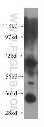 EMAP II Antibody in Western Blot (WB)