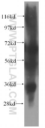 EMAP II Antibody in Western Blot (WB)