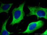 EMAP II Antibody in Immunocytochemistry (ICC/IF)