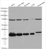 EMAP II Antibody in Western Blot (WB)