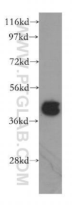 CCDC5 Antibody in Western Blot (WB)