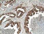 CCDC5 Antibody in Immunohistochemistry (Paraffin) (IHC (P))