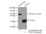 CCDC5 Antibody in Immunoprecipitation (IP)