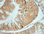 OSBP Antibody in Immunohistochemistry (Paraffin) (IHC (P))