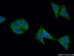 FGFR4 Antibody in Immunocytochemistry (ICC/IF)