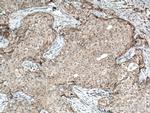 FGFR4 Antibody in Immunohistochemistry (Paraffin) (IHC (P))