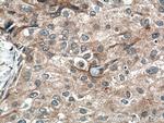 FGFR4 Antibody in Immunohistochemistry (Paraffin) (IHC (P))