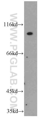 FGFR4 Antibody in Western Blot (WB)