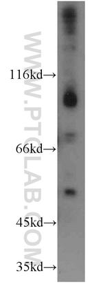 FGFR4 Antibody in Western Blot (WB)