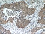 SHMT2 Antibody in Immunohistochemistry (Paraffin) (IHC (P))